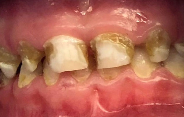 Фото ДО